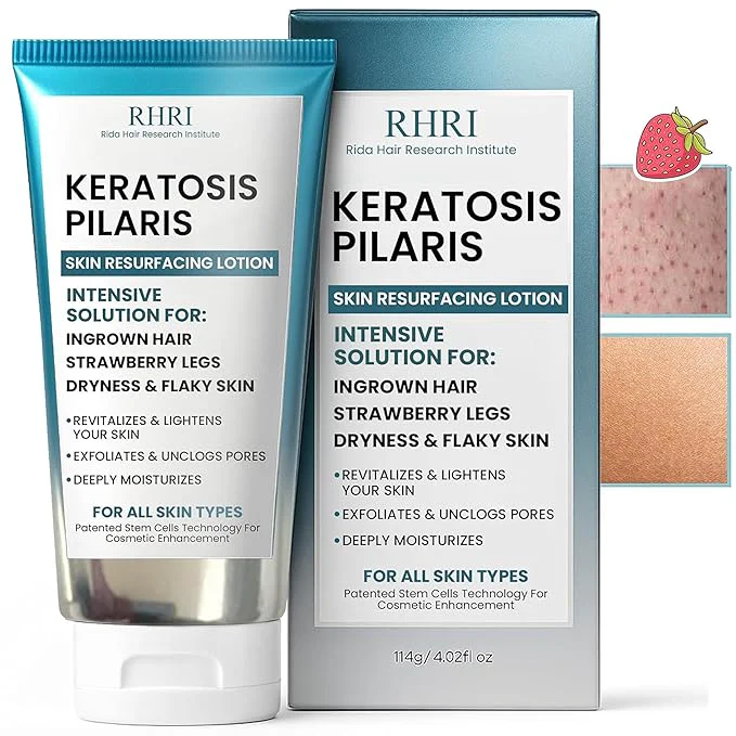 Secure Keratosis Pilaris Treatment Keratosis Pilaris Lotion Sophisticated